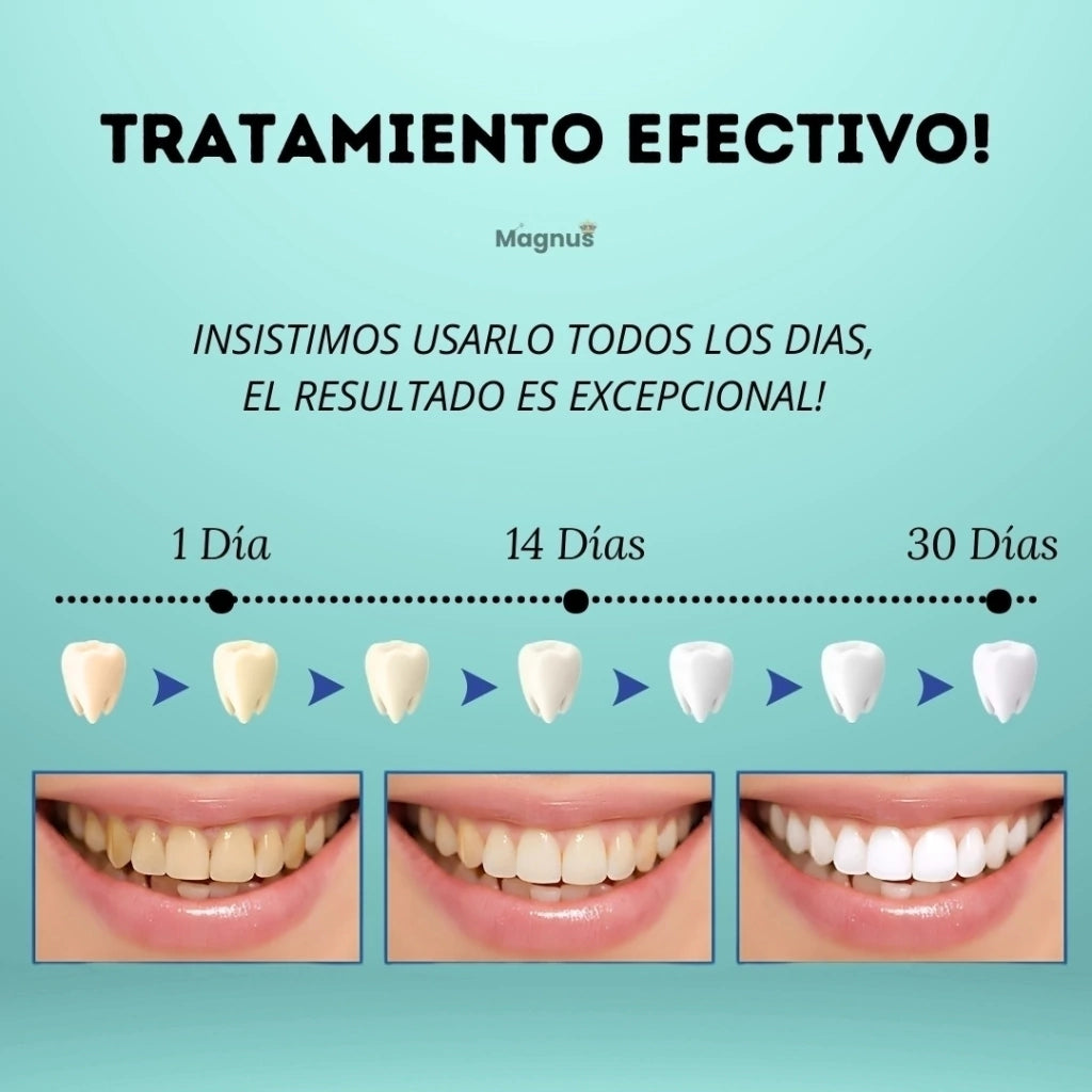 Lápiz Blanqueador Dientes Instantáneo